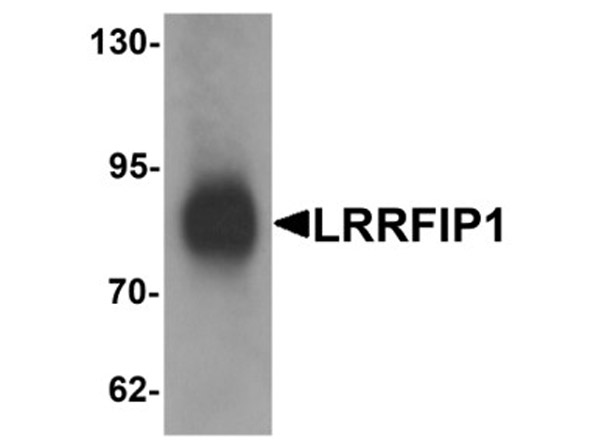 Western blot analysis of LRRFIP1