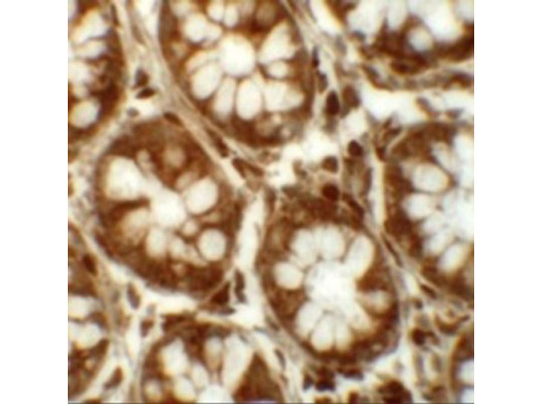 Immunohistochemistry of LRRFIP2