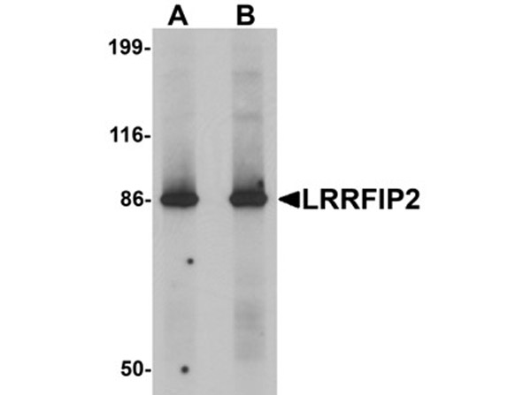 Western blot analysis of LRRFIP2