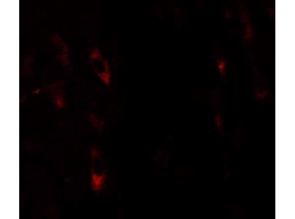 Immunofluorescence of LRRTM1