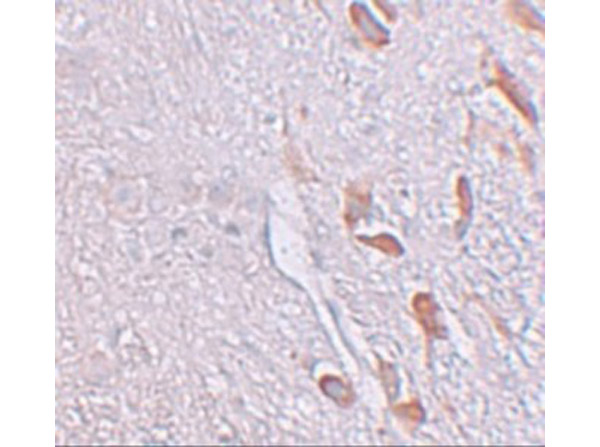 Immunohistochemistry of LRRTM1