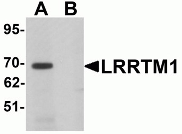 Western blot analysis of LRRTM1