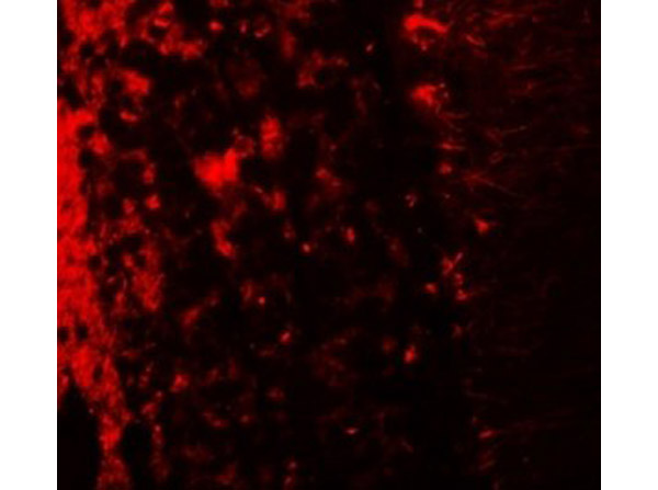 Immunofluorescence of LRRTM2