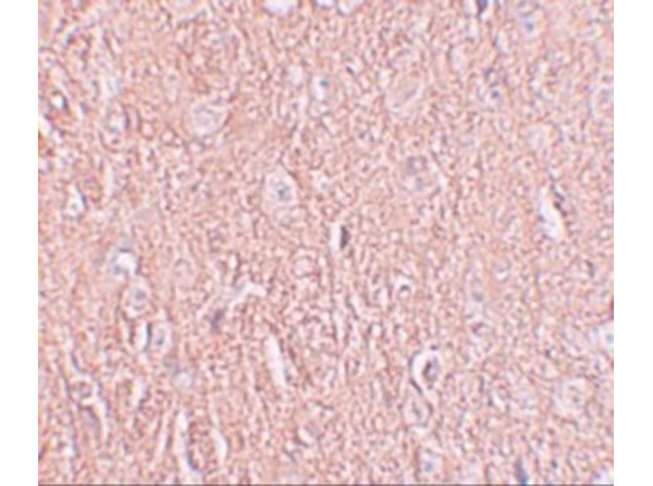 Immunohistochemistry of LRRTM2