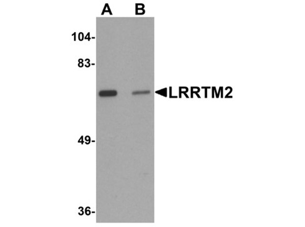 Western blot analysis of LRRTM2