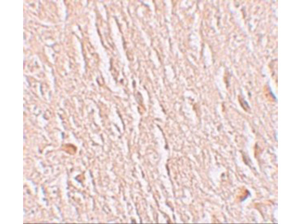 Immunohistochemistry of LRRTM3