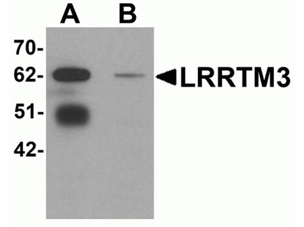 Western blot analysis of LRRTM3