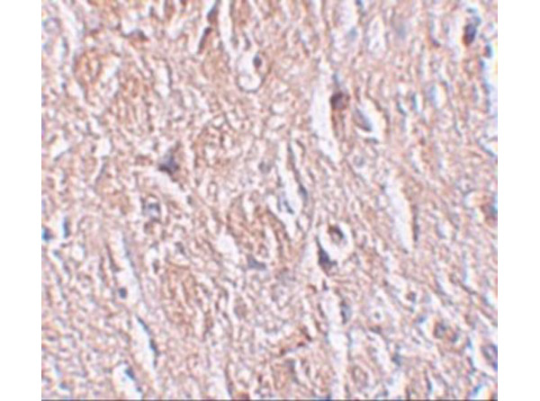 Immunohistochemistry of LRRTM4