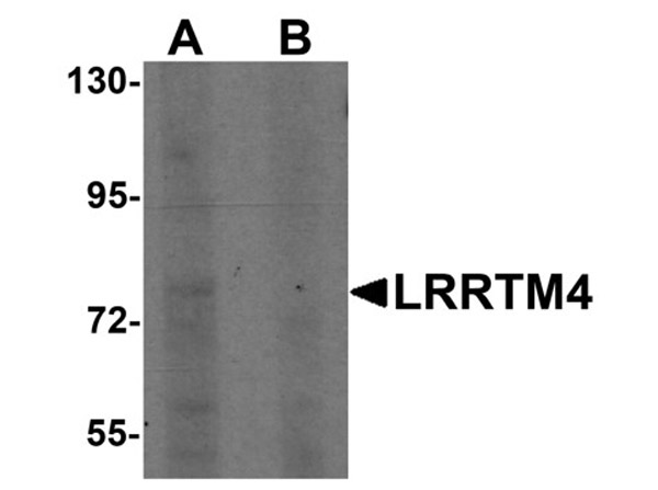 Western blot analysis of LRRTM4