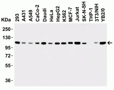 Western Blot of LSD1