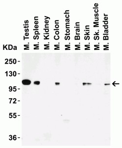 Western Blot of LSD1