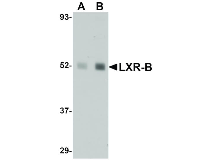 Western Blot of LXR-B Antibody