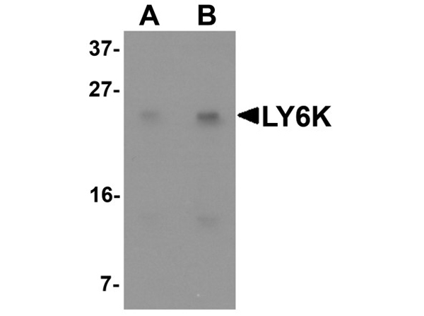 Western blot analysis of LY6K