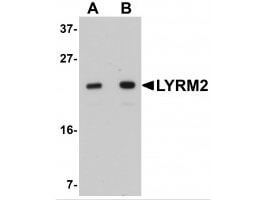 Western Blot of LYRM2 Antibody