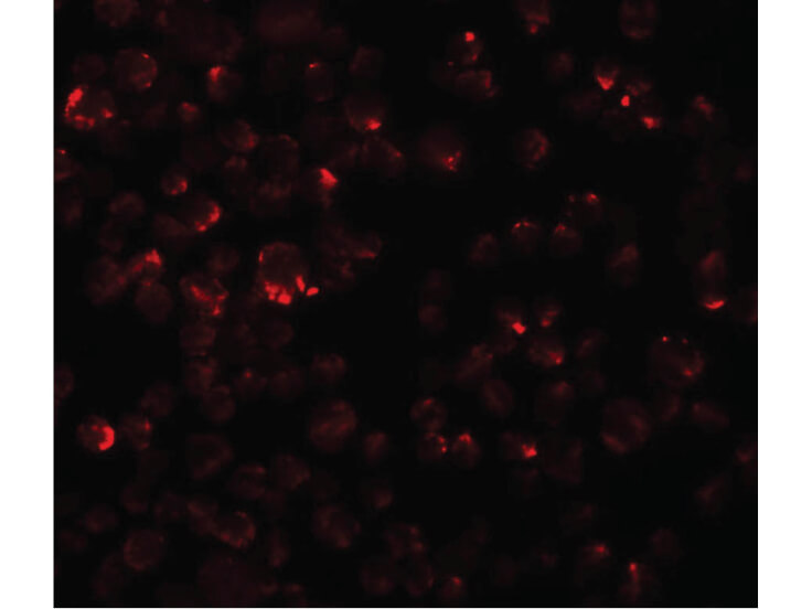 Immunofluorescence of LYRM2 Antibody