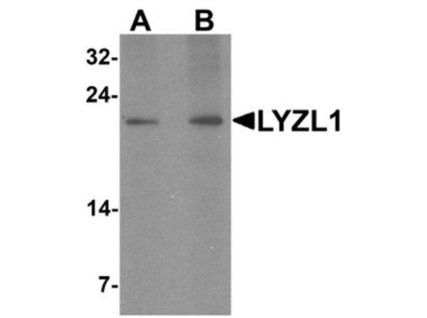 Western blot analysis of LYZL1