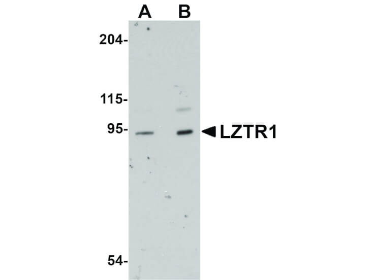 Western Blot of LZTR1 Antibody