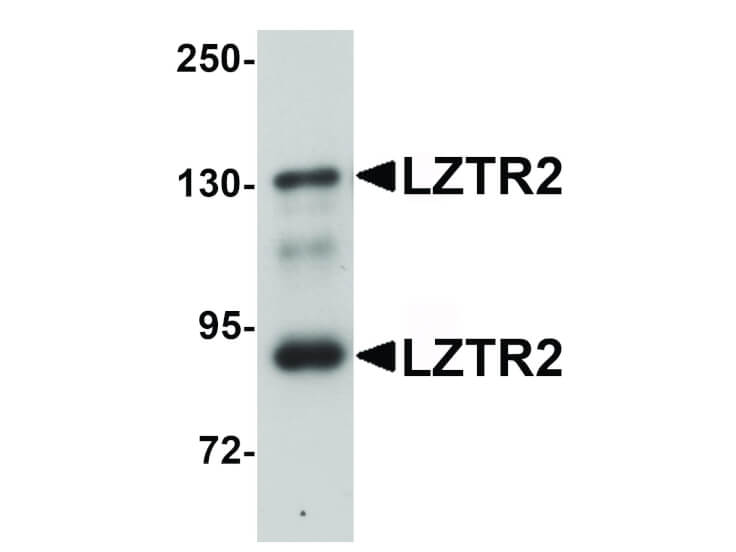 Western Blot of LZTR2 Antibody