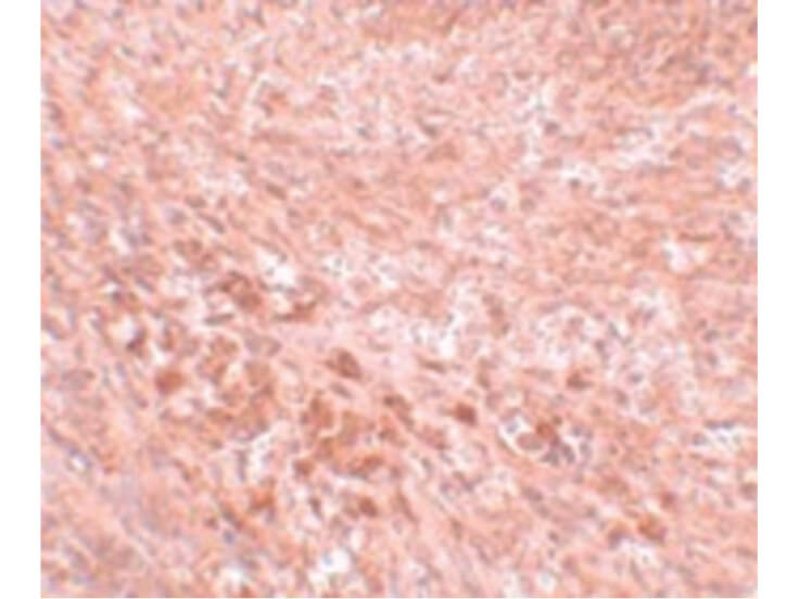 Immunohistochemistry of LZTR2 Antibody