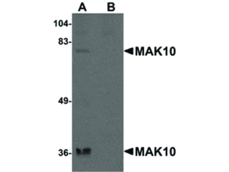 Western Blot of MAK10 Antibody