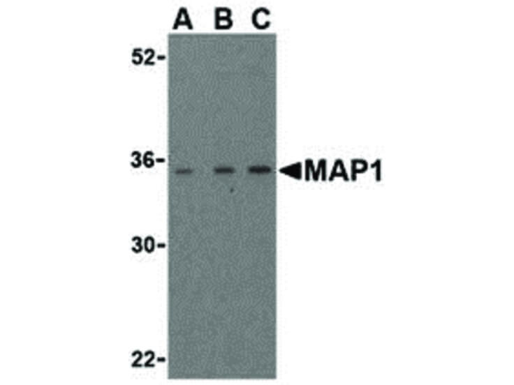 Western Blot of MAP1 Antibody