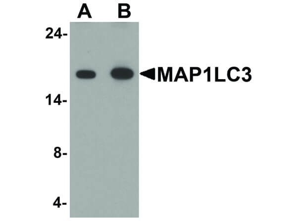Western Blot of MAP1LC3 Antibody