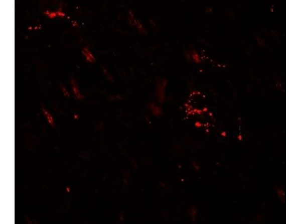 Immunofluorescence of MAP1LC3A