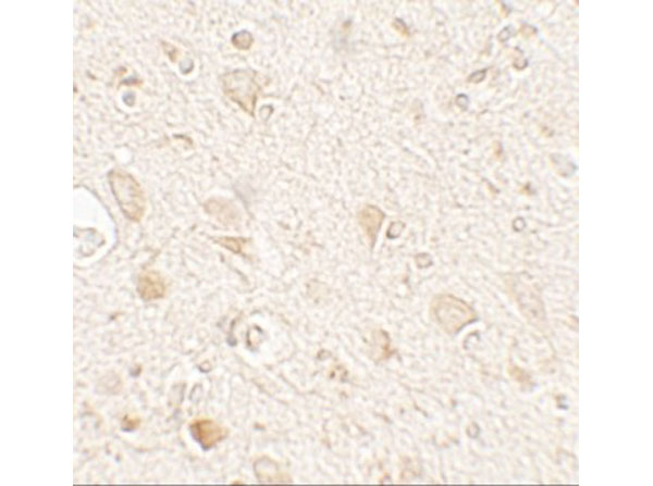 Immunohistochemistry of MAP1LC3A