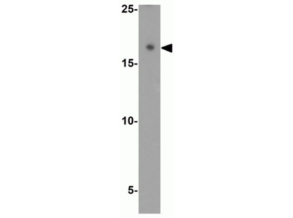 Western blot of MAP1LC3A