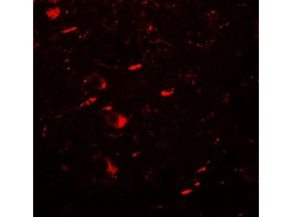 Immunofluorescence of MAP1LC3B