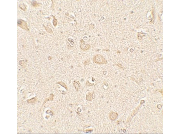 Immunohistochemistry of MAP1LC3B