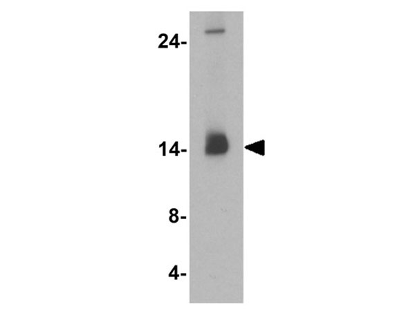 Western blot of MAP1LC3B