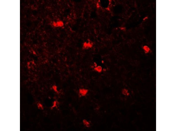 Immunofluorescence of MAP1LC3C