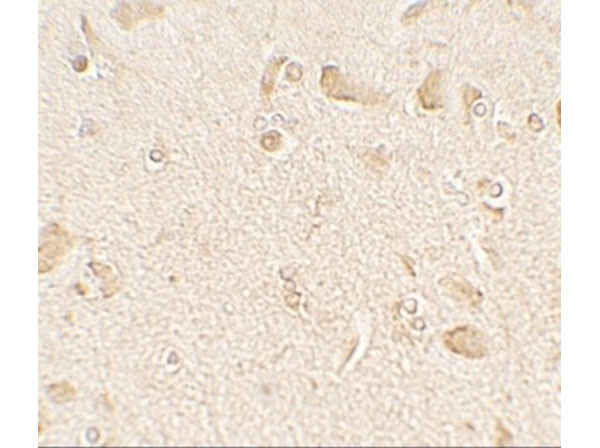 Immunohistochemistry of MAP1LC3C
