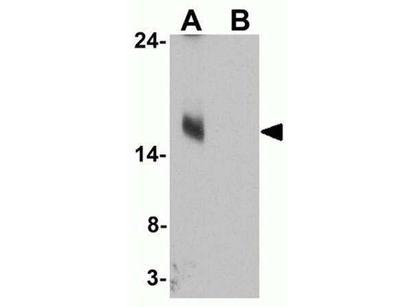 Western blot of MAP1LC3C