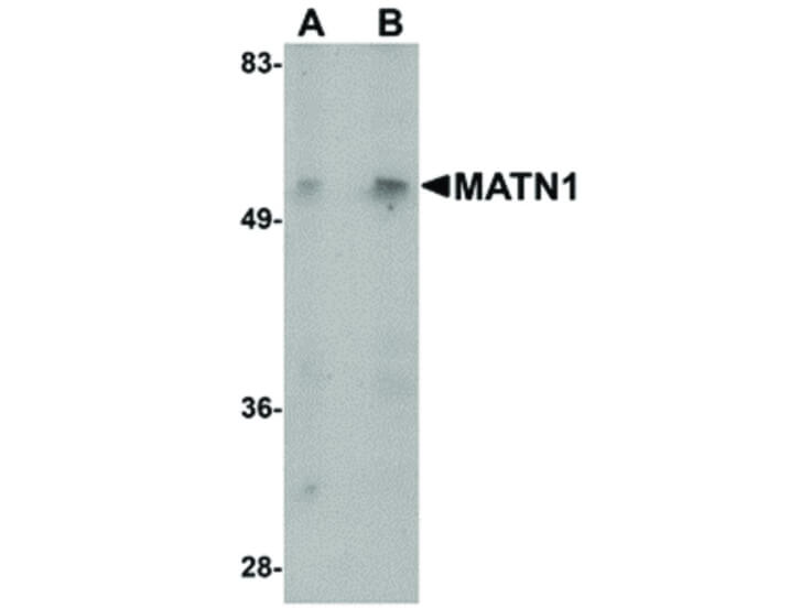 Western Blot of MATN1 Antibody