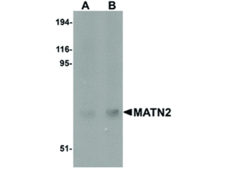 Western Blot of MATN2 Antibody