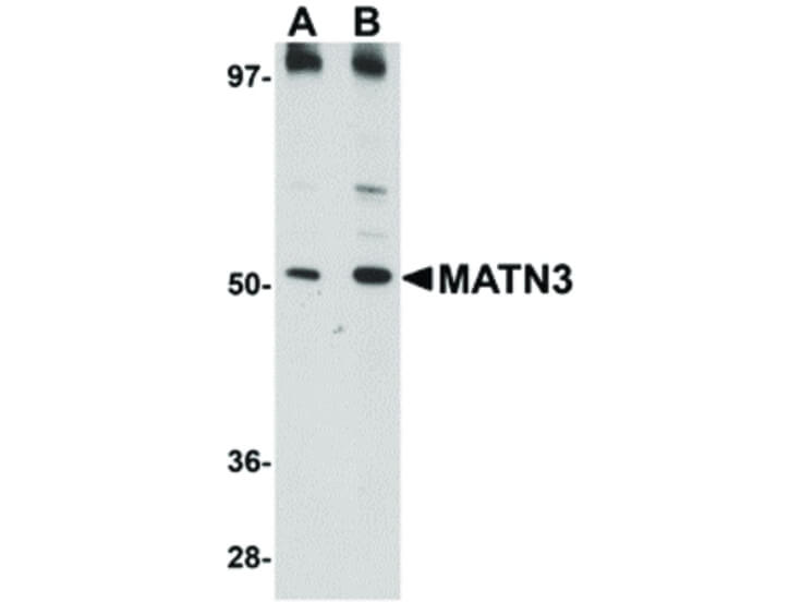 Western Blot of MATN3 Antibody
