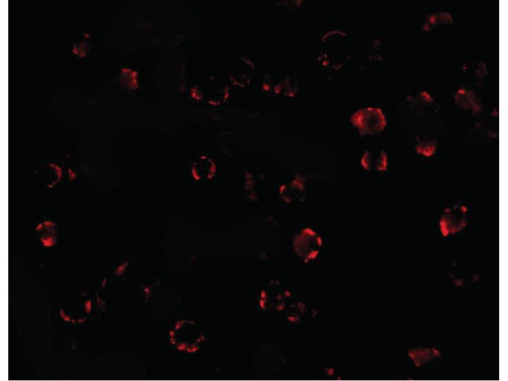 Immunofluorescence of MATN3 Antibody