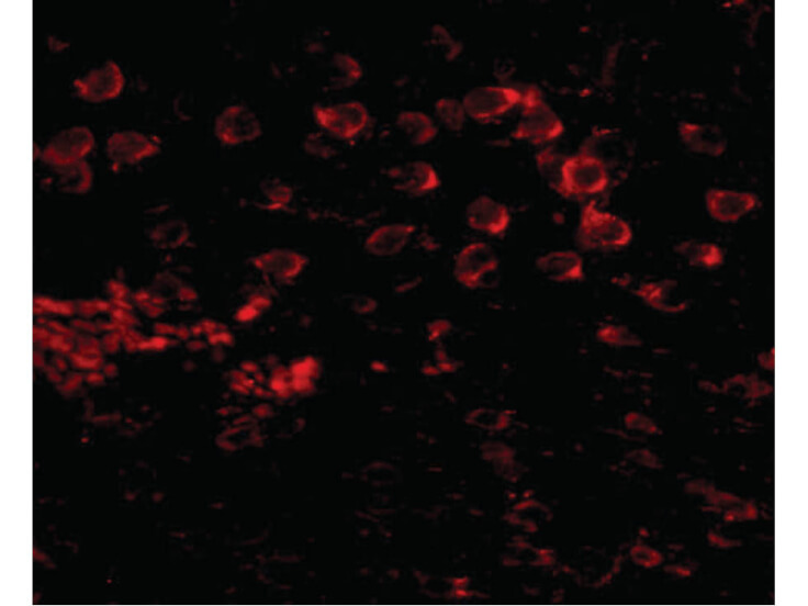 Immunofluorescence of MATN4 Antibody