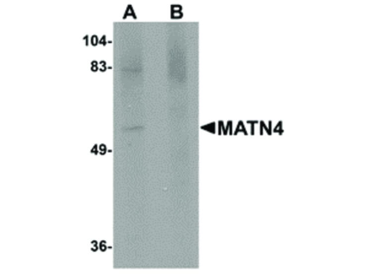 Western Blot of MATN4 Antibody
