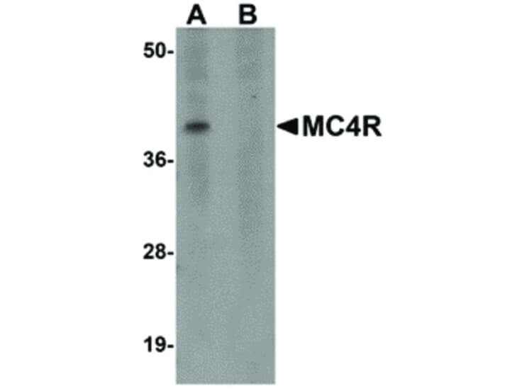 Western Blot of MC4R Antibody