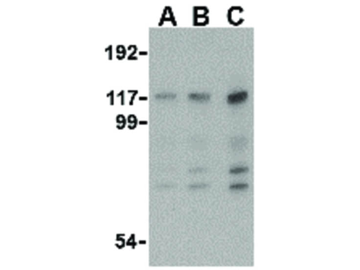 Western Blot of MDA5 Antibody
