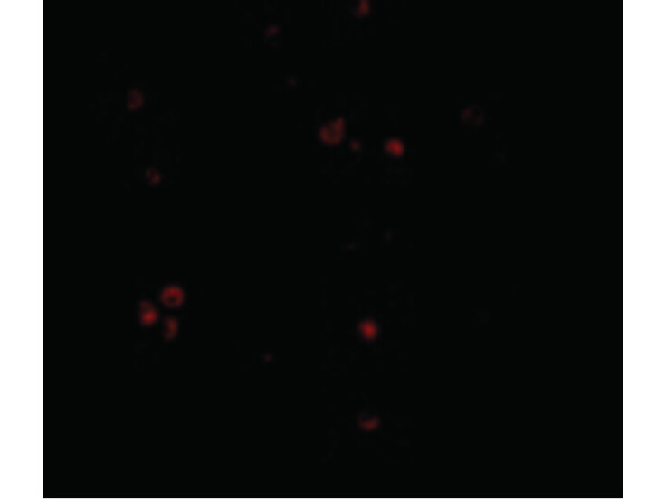 Immunofluorescence of MDA5 Antibody