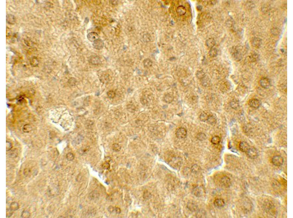 Immunohistochemistry of ME1