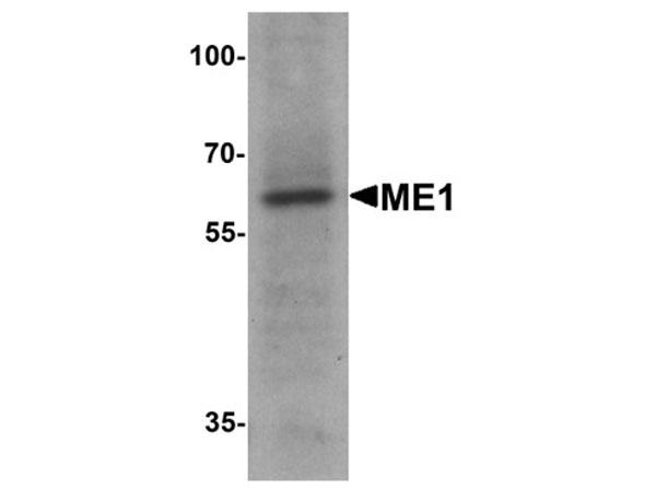Western blot of ME1