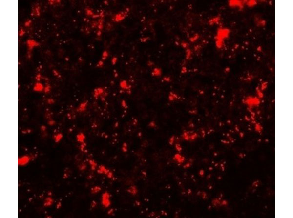 Immunofluorescence of ME2
