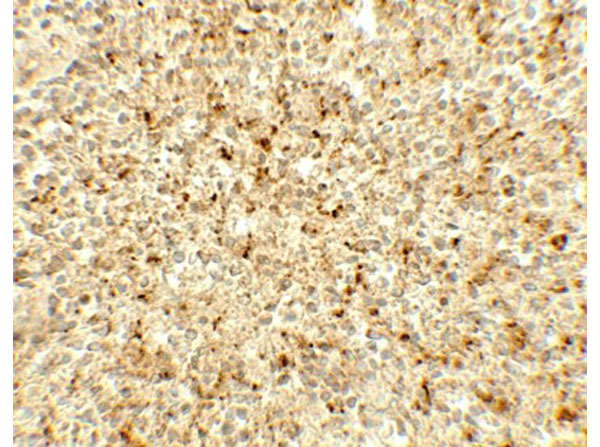 Immunohistochemistry of ME2