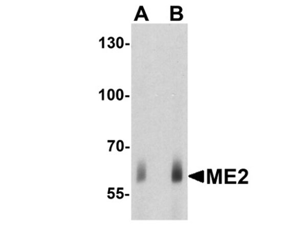 Western blot of ME2