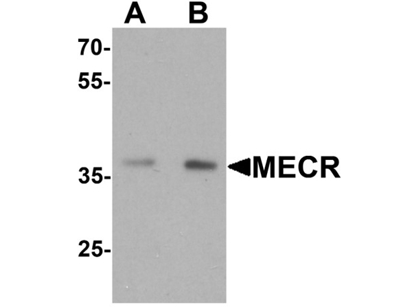 Western blot analysis of MECR
